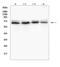 Interferon Alpha And Beta Receptor Subunit 2 antibody, A02056-3, Boster Biological Technology, Western Blot image 