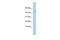 Apolipoprotein B MRNA Editing Enzyme Catalytic Subunit 3F antibody, GTX47416, GeneTex, Western Blot image 