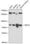 Transient Receptor Potential Cation Channel Subfamily V Member 5 antibody, 22-252, ProSci, Western Blot image 