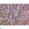 Interferon Alpha And Beta Receptor Subunit 1 antibody, LS-C814237, Lifespan Biosciences, Immunohistochemistry paraffin image 