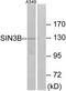 Paired amphipathic helix protein Sin3b antibody, TA315238, Origene, Western Blot image 