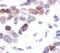 Histone Cluster 1 H2B Family Member B antibody, PA5-17779, Invitrogen Antibodies, Immunohistochemistry paraffin image 