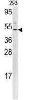 Fli-1 Proto-Oncogene, ETS Transcription Factor antibody, GTX81877, GeneTex, Western Blot image 