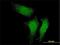 RuvB Like AAA ATPase 1 antibody, H00008607-M01, Novus Biologicals, Immunocytochemistry image 