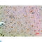 C-C Motif Chemokine Ligand 14 antibody, LS-C813784, Lifespan Biosciences, Immunohistochemistry paraffin image 