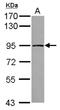 Threonyl-TRNA Synthetase 2, Mitochondrial antibody, NBP2-20568, Novus Biologicals, Western Blot image 