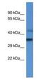 Mitochondrial Ribosomal Protein L45 antibody, NBP1-74262, Novus Biologicals, Western Blot image 