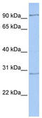 H6 Family Homeobox 2 antibody, TA339686, Origene, Western Blot image 