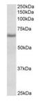 Cytochrome B5 Reductase 4 antibody, orb12356, Biorbyt, Western Blot image 