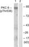 Protein Kinase C Theta antibody, LS-C199455, Lifespan Biosciences, Western Blot image 