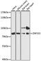Zinc Finger Protein 333 antibody, GTX66216, GeneTex, Western Blot image 
