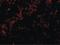 BH3 Interacting Domain Death Agonist antibody, LS-B2715, Lifespan Biosciences, Immunofluorescence image 
