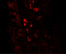 GLI Pathogenesis Related 1 antibody, LS-C201173, Lifespan Biosciences, Immunofluorescence image 