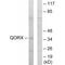 Quinone oxidoreductase PIG3 antibody, A06870, Boster Biological Technology, Western Blot image 