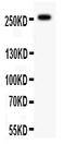 ATP Binding Cassette Subfamily A Member 4 antibody, PA2066, Boster Biological Technology, Western Blot image 