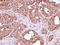 Fission, Mitochondrial 1 antibody, LS-C186184, Lifespan Biosciences, Immunohistochemistry paraffin image 