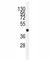 Vascular Endothelial Growth Factor C antibody, F40253-0.4ML, NSJ Bioreagents, Western Blot image 