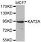 Lysine Acetyltransferase 2A antibody, abx001825, Abbexa, Western Blot image 