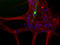 Neurofilament Light antibody, LS-B10417, Lifespan Biosciences, Immunocytochemistry image 