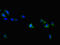 Transient Receptor Potential Cation Channel Subfamily M Member 6 antibody, LS-C676651, Lifespan Biosciences, Immunofluorescence image 