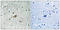 ABL Proto-Oncogene 1, Non-Receptor Tyrosine Kinase antibody, LS-C118040, Lifespan Biosciences, Immunohistochemistry paraffin image 