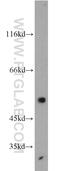 ET-BR antibody, 20964-1-AP, Proteintech Group, Western Blot image 