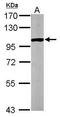 Glycogen Phosphorylase B antibody, GTX104291, GeneTex, Western Blot image 