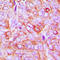 Integrin Subunit Beta 3 antibody, LS-C356143, Lifespan Biosciences, Immunohistochemistry paraffin image 