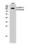 EPH Receptor B1 antibody, STJ90711, St John