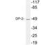 Transcription Factor Dp-2 antibody, LS-C199831, Lifespan Biosciences, Western Blot image 