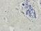 E3 ubiquitin ligase RNF4 antibody, orb163564, Biorbyt, Immunohistochemistry paraffin image 