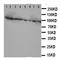 Coagulation Factor VIII antibody, orb99223, Biorbyt, Western Blot image 