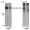 Neurofibromin 1 antibody, ab17963, Abcam, Western Blot image 