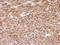 Chaperonin Containing TCP1 Subunit 8 Like 2 antibody, NBP2-15865, Novus Biologicals, Immunohistochemistry paraffin image 