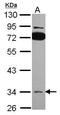 Solute Carrier Family 25 Member 22 antibody, GTX116838, GeneTex, Western Blot image 