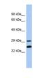 G1 To S Phase Transition 2 antibody, orb325982, Biorbyt, Western Blot image 