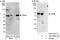 TRNA Methyltransferase 6 antibody, A303-008A, Bethyl Labs, Western Blot image 