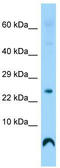 LYR Motif Containing 9 antibody, TA332225, Origene, Western Blot image 