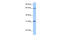 Zinc Finger Protein 394 antibody, 29-105, ProSci, Western Blot image 