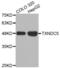 Thioredoxin Domain Containing 5 antibody, abx002532, Abbexa, Western Blot image 