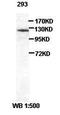 Zinc Finger E-Box Binding Homeobox 1 antibody, orb77113, Biorbyt, Western Blot image 