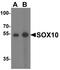 SRY-Box 10 antibody, A00758, Boster Biological Technology, Western Blot image 
