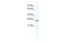 Aryl Hydrocarbon Receptor Nuclear Translocator Like antibody, 28-566, ProSci, Western Blot image 