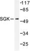 Serum/Glucocorticoid Regulated Kinase 1 antibody, AP06580PU-N, Origene, Western Blot image 