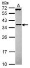 Eukaryotic Translation Initiation Factor 3 Subunit J antibody, GTX115121, GeneTex, Western Blot image 