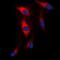 Microtubule Associated Serine/Threonine Kinase 2 antibody, orb215071, Biorbyt, Immunocytochemistry image 