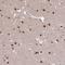 Suppression Of Tumorigenicity 5 antibody, HPA046796, Atlas Antibodies, Immunohistochemistry paraffin image 