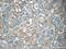 Transmembrane Protein 199 antibody, 25489-1-AP, Proteintech Group, Immunohistochemistry paraffin image 
