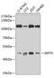 Septin-4 antibody, GTX64518, GeneTex, Western Blot image 