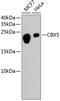 Chromobox 5 antibody, 13-998, ProSci, Western Blot image 